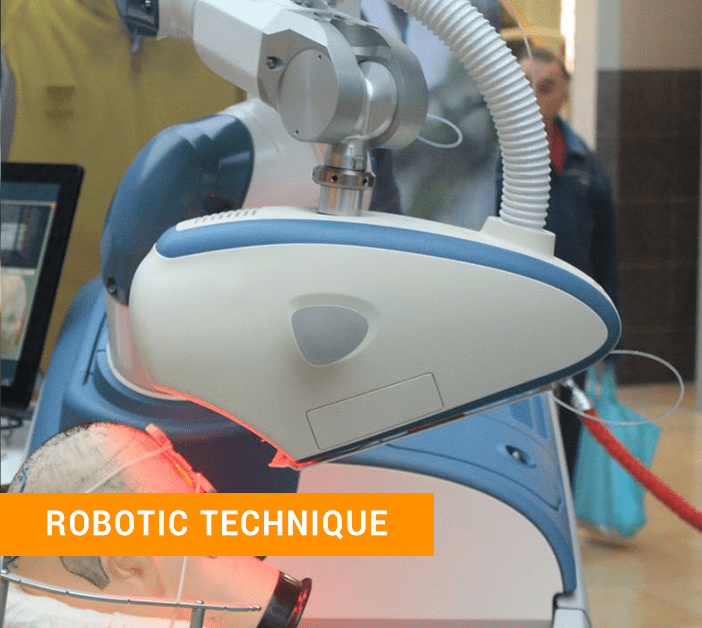 Robotic hair transplant